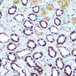 Anti-COX5B antibody used in IHC (Paraffin sections) (IHC-P). GTX33114