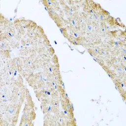 Anti-COX6B1 antibody used in IHC (Paraffin sections) (IHC-P). GTX33115