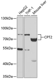 Anti-CPT2 antibody used in Western Blot (WB). GTX33117