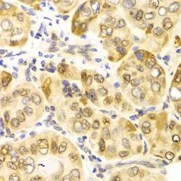 Anti-CPT2 antibody used in IHC (Paraffin sections) (IHC-P). GTX33117