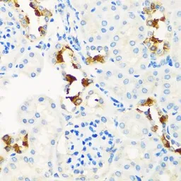 Anti-CPT2 antibody used in IHC (Paraffin sections) (IHC-P). GTX33117