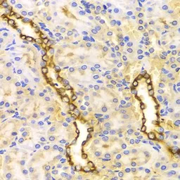 Anti-CPT2 antibody used in IHC (Paraffin sections) (IHC-P). GTX33117