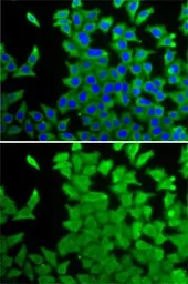 Anti-CRABP2 antibody used in Immunocytochemistry/ Immunofluorescence (ICC/IF). GTX33118