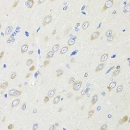 Anti-CRABP2 antibody used in IHC (Paraffin sections) (IHC-P). GTX33118