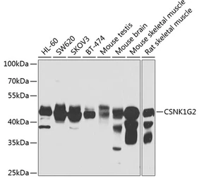 Anti-Casein Kinase 1 gamma 2 antibody used in Western Blot (WB). GTX33123