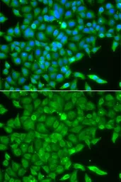 Anti-Casein Kinase 1 gamma 2 antibody used in Immunocytochemistry/ Immunofluorescence (ICC/IF). GTX33123