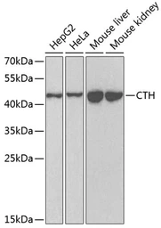 Anti-CTH antibody used in Western Blot (WB). GTX33125