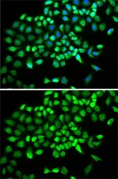 Anti-Cullin 2 antibody used in Immunocytochemistry/ Immunofluorescence (ICC/IF). GTX33127