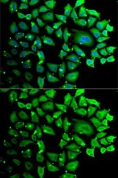 Anti-Cyclin C antibody used in Immunocytochemistry/ Immunofluorescence (ICC/IF). GTX33132