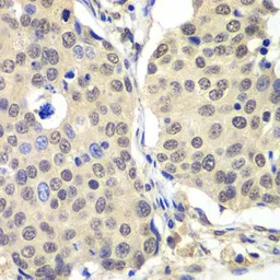 Anti-Cyclin C antibody used in IHC (Paraffin sections) (IHC-P). GTX33132