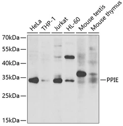 Anti-Cyclophilin E antibody used in Western Blot (WB). GTX33133