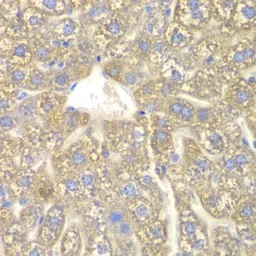 Anti-CYP2C18 antibody used in IHC (Paraffin sections) (IHC-P). GTX33135