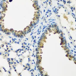 Anti-CYP2F1 antibody used in IHC (Paraffin sections) (IHC-P). GTX33136
