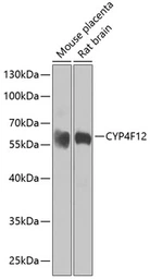 Anti-CYP4F12 antibody used in Western Blot (WB). GTX33137