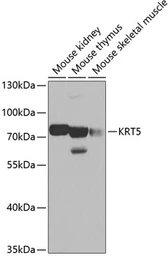 Anti-Cytokeratin 5 antibody used in Western Blot (WB). GTX33140