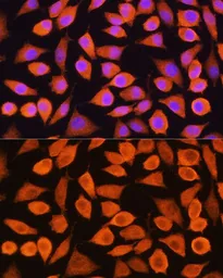 Anti-Cytokeratin 5 antibody used in Immunocytochemistry/ Immunofluorescence (ICC/IF). GTX33140