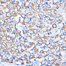 Anti-Cytokeratin 5 antibody used in IHC (Paraffin sections) (IHC-P). GTX33140