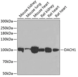 Anti-DACH1 antibody used in Western Blot (WB). GTX33142