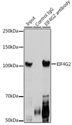 Anti-DAP5 antibody used in Immunoprecipitation (IP). GTX33144