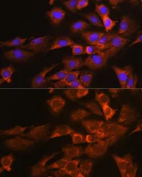 Anti-DAP5 antibody used in Immunocytochemistry/ Immunofluorescence (ICC/IF). GTX33144