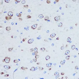 Anti-DAP5 antibody used in IHC (Paraffin sections) (IHC-P). GTX33144