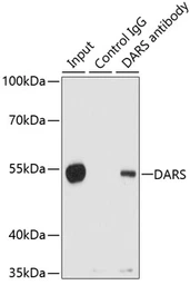 Anti-DARS antibody used in Immunoprecipitation (IP). GTX33145