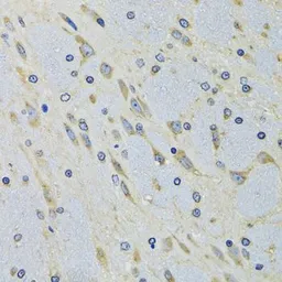 Anti-DARS antibody used in IHC (Paraffin sections) (IHC-P). GTX33145