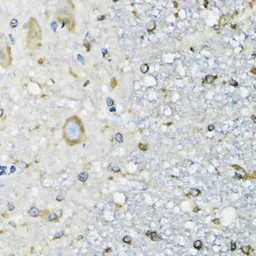 Anti-DARS antibody used in IHC (Paraffin sections) (IHC-P). GTX33145