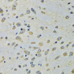 Anti-DARS antibody used in IHC (Paraffin sections) (IHC-P). GTX33145