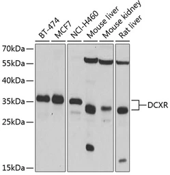 Anti-DCXR antibody used in Western Blot (WB). GTX33148