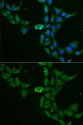 Anti-DDX1 antibody used in Immunocytochemistry/ Immunofluorescence (ICC/IF). GTX33149