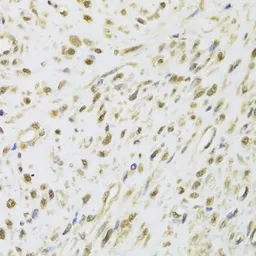 Anti-DDX1 antibody used in IHC (Paraffin sections) (IHC-P). GTX33149