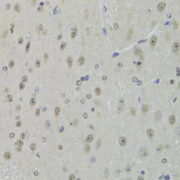 Anti-DDX1 antibody used in IHC (Paraffin sections) (IHC-P). GTX33149