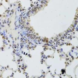 Anti-DDX1 antibody used in IHC (Paraffin sections) (IHC-P). GTX33149