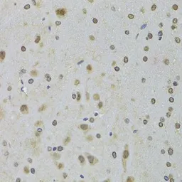 Anti-DDX1 antibody used in IHC (Paraffin sections) (IHC-P). GTX33149