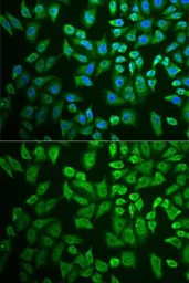 Anti-DDX41 antibody used in Immunocytochemistry/ Immunofluorescence (ICC/IF). GTX33151