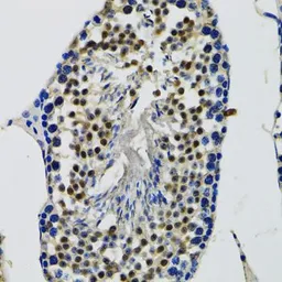Anti-DDX41 antibody used in IHC (Paraffin sections) (IHC-P). GTX33151