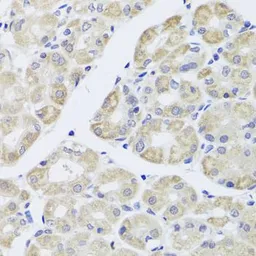 Anti-DISC1 antibody used in IHC (Paraffin sections) (IHC-P). GTX33154