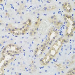 Anti-DISC1 antibody used in IHC (Paraffin sections) (IHC-P). GTX33154