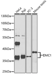 Anti-DMC1 antibody used in Western Blot (WB). GTX33157