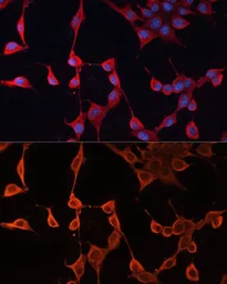 Anti-DNAJA2 antibody used in Immunocytochemistry/ Immunofluorescence (ICC/IF). GTX33159