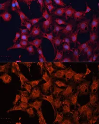 Anti-DNAJA2 antibody used in Immunocytochemistry/ Immunofluorescence (ICC/IF). GTX33159
