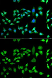 Anti-DNAJB6 antibody used in Immunocytochemistry/ Immunofluorescence (ICC/IF). GTX33160