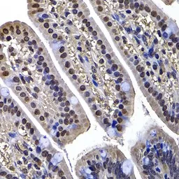 Anti-DNAJB6 antibody used in IHC (Paraffin sections) (IHC-P). GTX33160