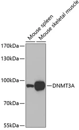 Anti-DNMT3A antibody used in Western Blot (WB). GTX33161