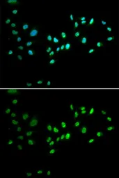 Anti-DNMT3A antibody used in Immunocytochemistry/ Immunofluorescence (ICC/IF). GTX33161