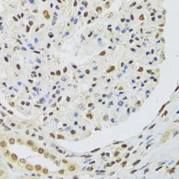 Anti-DNMT3A antibody used in IHC (Paraffin sections) (IHC-P). GTX33161