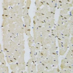 Anti-DNMT3A antibody used in IHC (Paraffin sections) (IHC-P). GTX33161