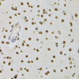 Anti-DNMT3A antibody used in IHC (Paraffin sections) (IHC-P). GTX33161