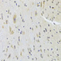 Anti-DPP3 antibody used in IHC (Paraffin sections) (IHC-P). GTX33164